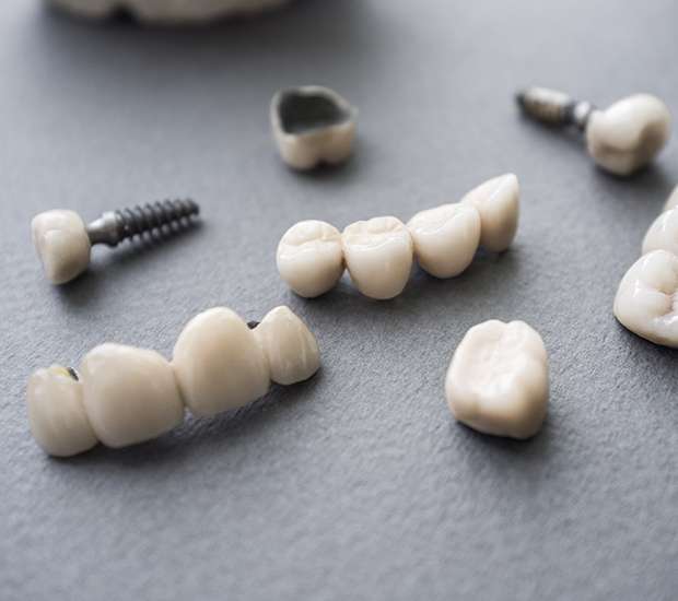 St. George The Difference Between Dental Implants and Mini Dental Implants