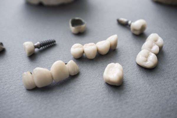 Types of Dental Implants from About Dental Care in St. George, UT