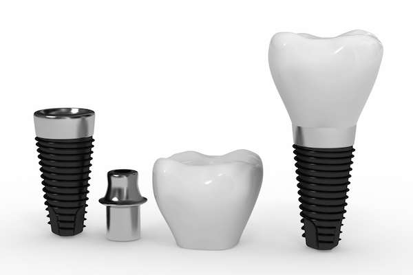 What Are the Parts of Dental Implants from About Dental Care in St. George, UT