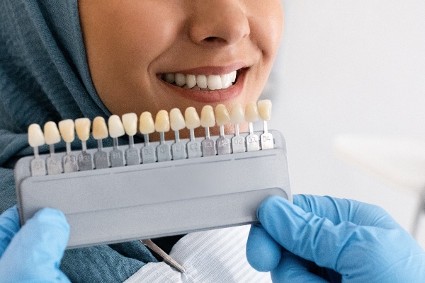 What Is The Process Of Getting Dental Veneers?