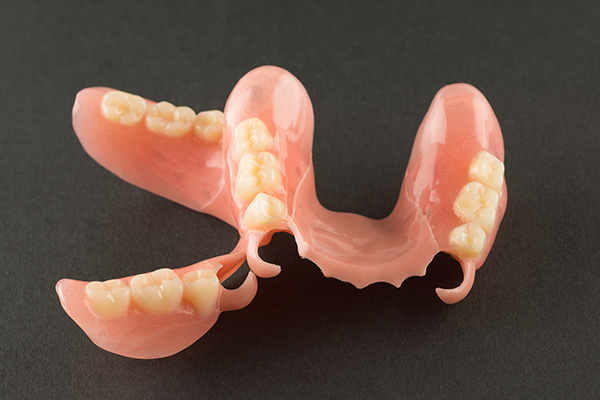 When Do You Need Dentures?